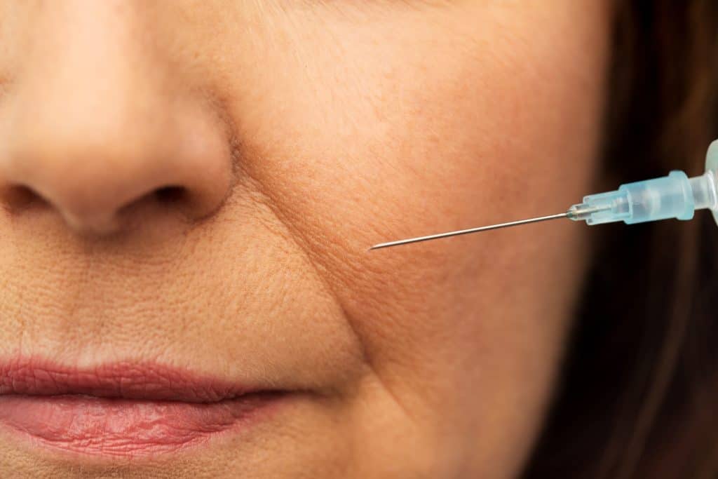 Anti-wrinkle injections